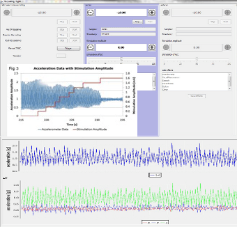 Clinical Electrophysiology and Accelerometry