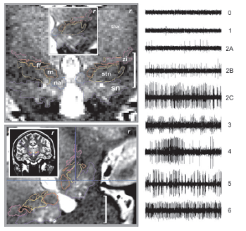 Clinical Electrophysiology
